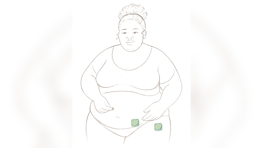 Best Place to Put Estrogen Patch