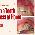 How to Drain Tooth Abscess at Home